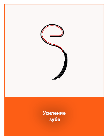 Усиление зуба